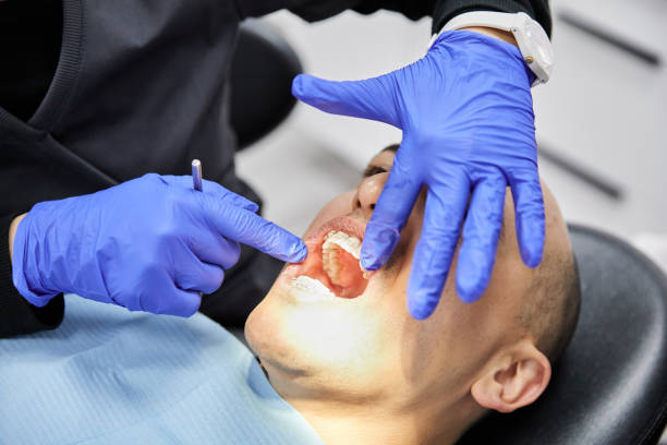 Best Broken or Chipped Tooth Repair in Stonebridge, NJ